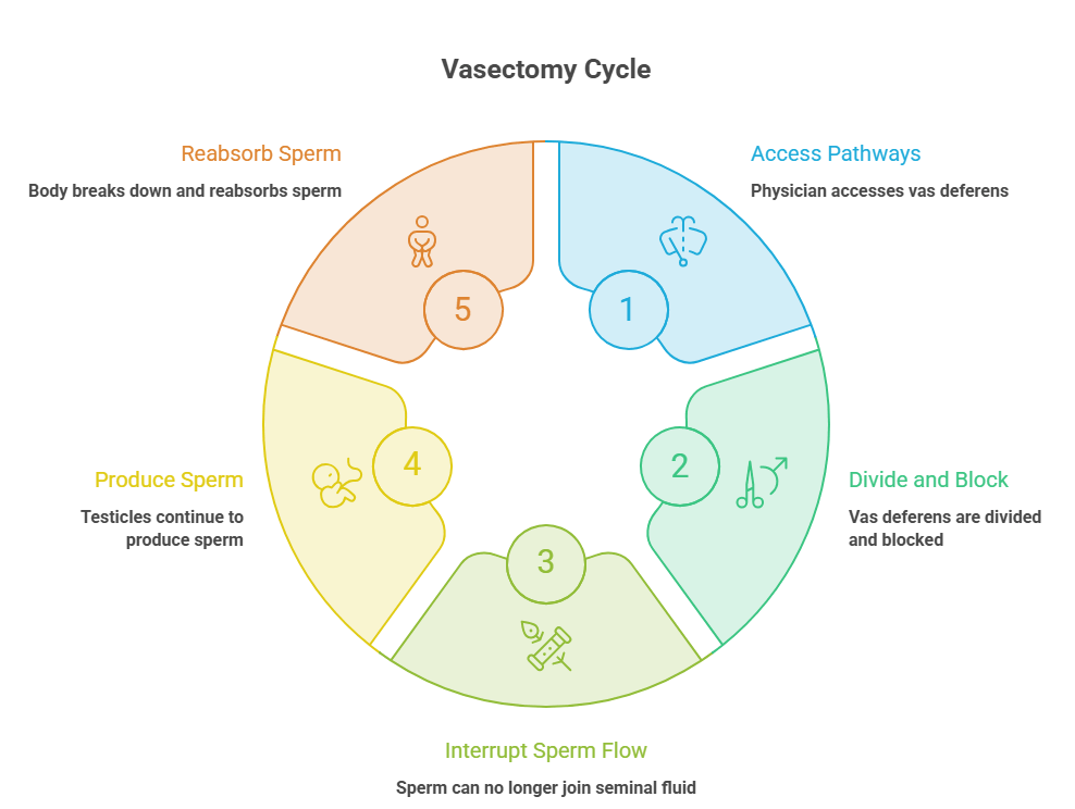 This image explains what a vasectomy is by discussing its process in five simple steps.